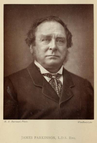 d parkinson